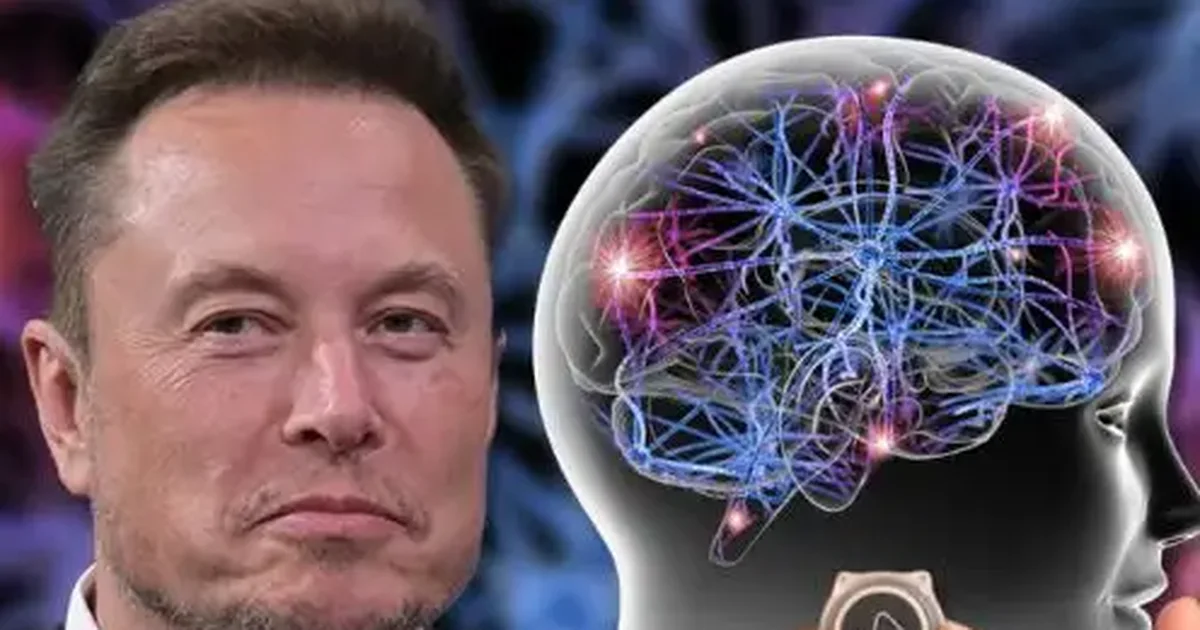 Elon Musk  Çipi në tru për rikthimin e shikimit te të verbrit do të instalohet brenda 2025